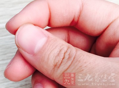 都說細節(jié)是真重要的一環(huán)，通過指甲竟也能了解自身的健康狀況