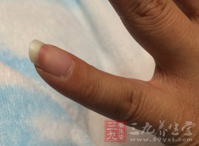 身體缺乏鈣質(zhì)、硫元素、鋅質(zhì)，或維生素A、B、C等;手指甲長時間與水接觸