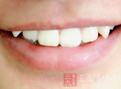 而說到牙垢，相信很多人都很頭痛